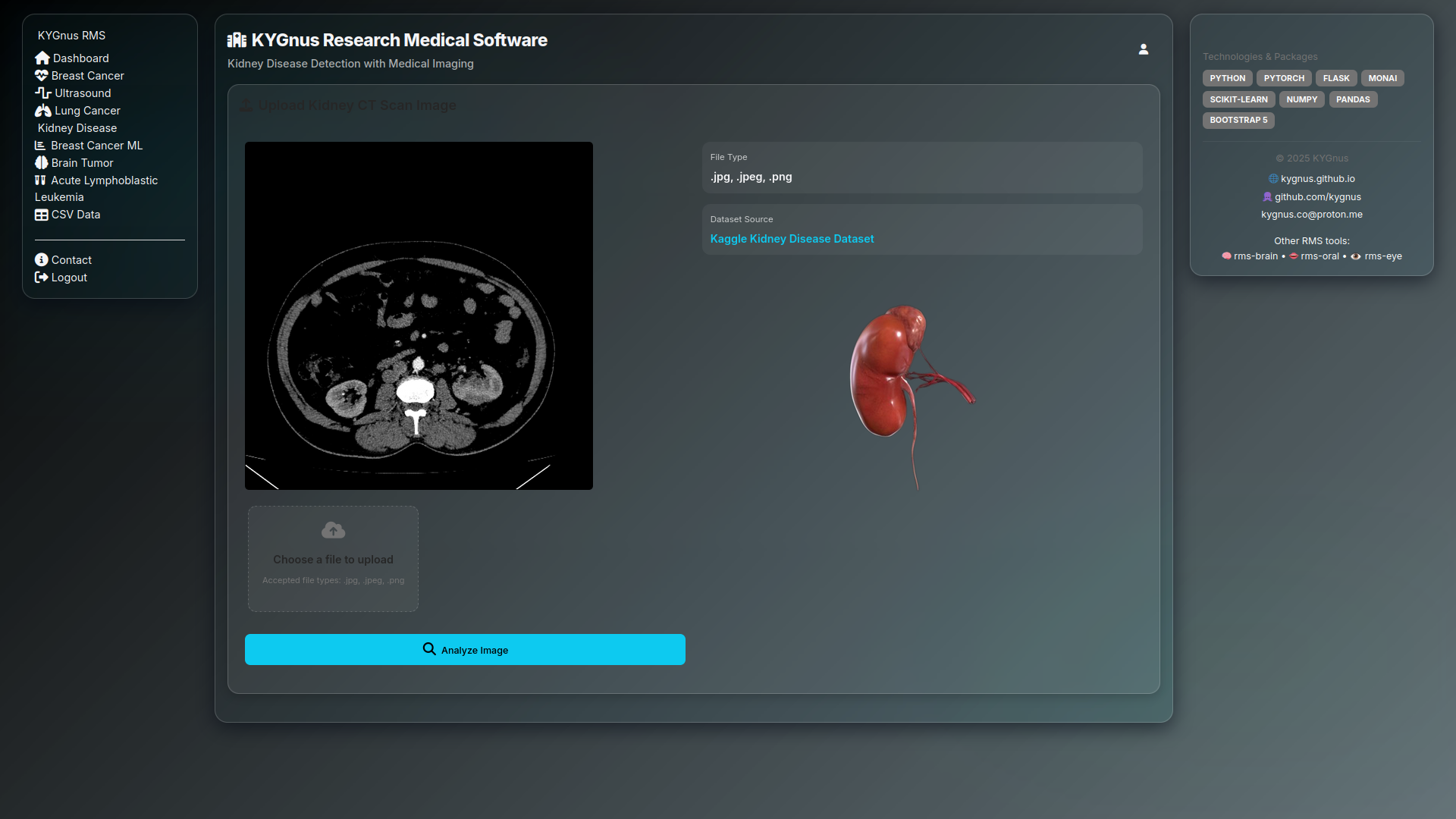 Breast Cancer Detection Interface